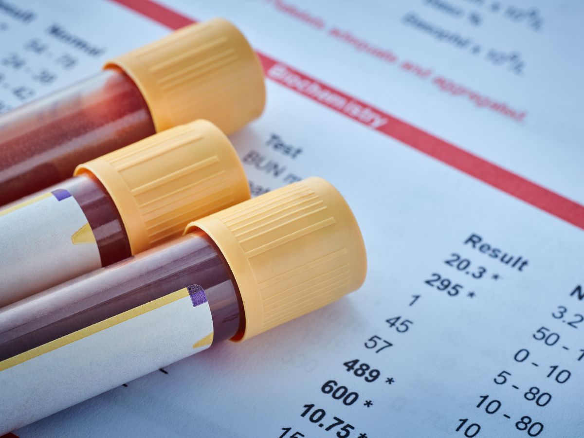 When to Refer for Blood Tests in Foot and Ankle Pain: Identifying Systemic Causes