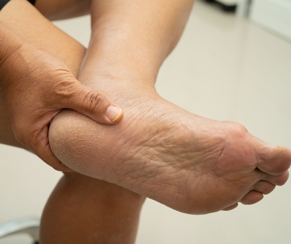 Heel Pain: What It Is and When to Seek Help